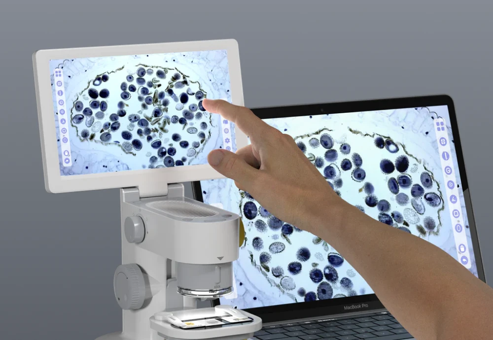 screen microscope